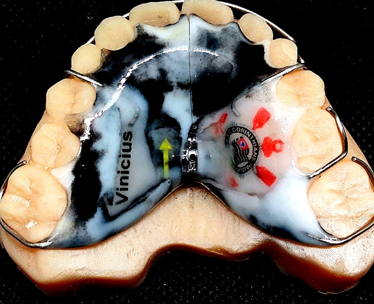 Foto 3 de Protesiart - Laboratório de Prótese Dentária