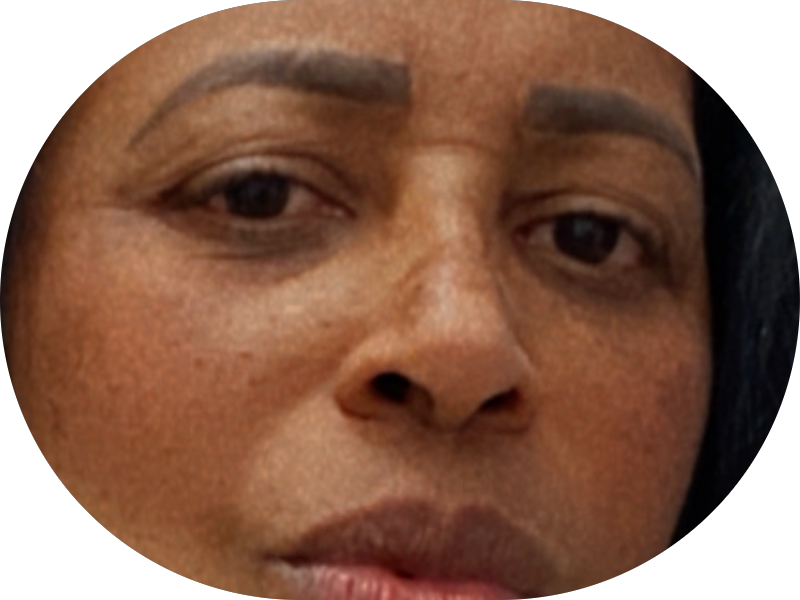 Foto 3 de PrótesiDent Odontologia Integrada