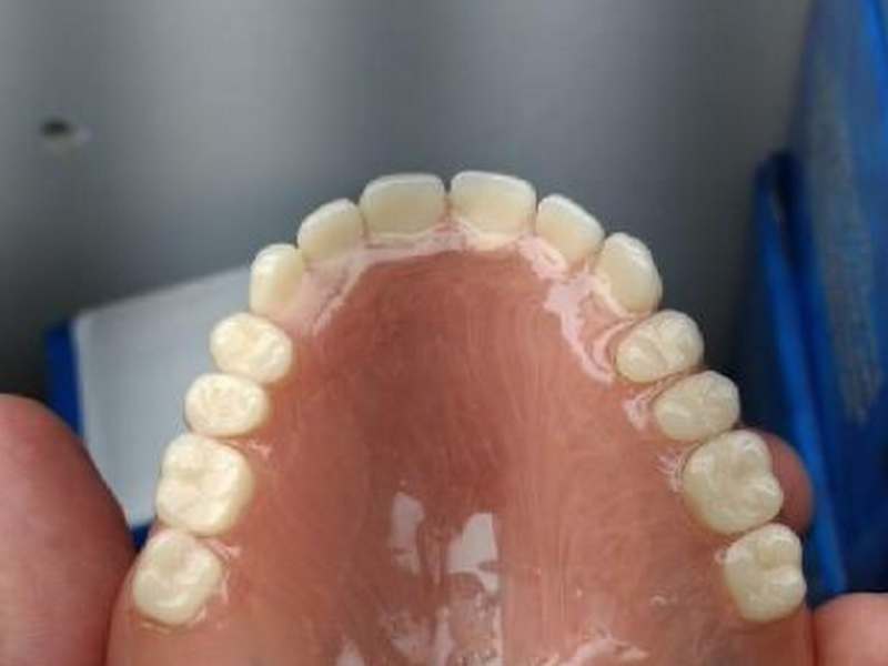 Foto 2 de Protetico Alexandre Azevedo