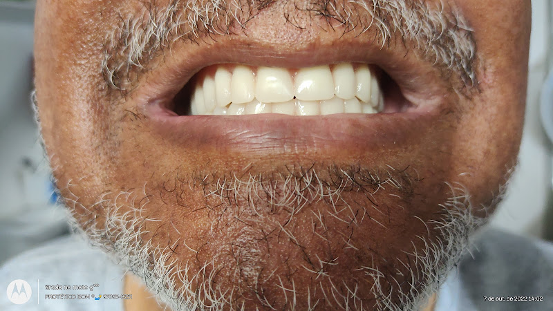 Foto 2 de Protético bom®