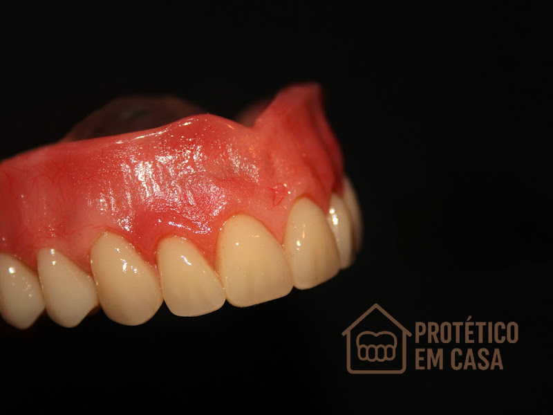 Foto de Protético em Casa - Atendemos Urgências! 20 anos de Experiência! Protese Flexível, Dentadura, Roach, Provisória.
