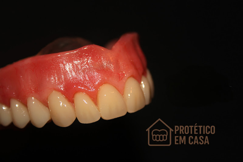 Foto 2 de Protético em Casa - Atendemos Urgências! 20 anos de Experiência! Protese Flexível, Dentadura, Roach, Provisória.