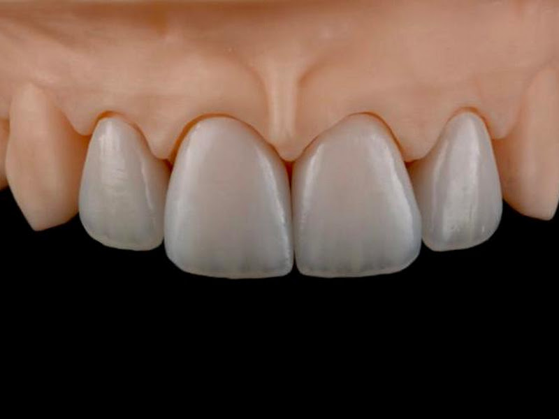 Foto 2 de Protético-Horácio Gomes