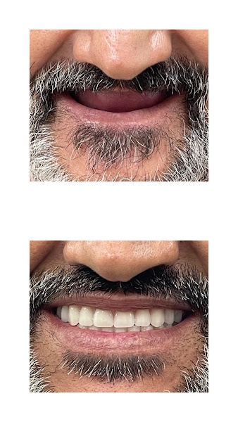 Foto 2 de Protético |Petrolina Prótese dentária em 7 dias!
