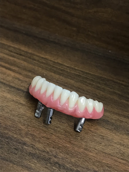 Foto 3 de Protético |Petrolina Prótese dentária em 7 dias!