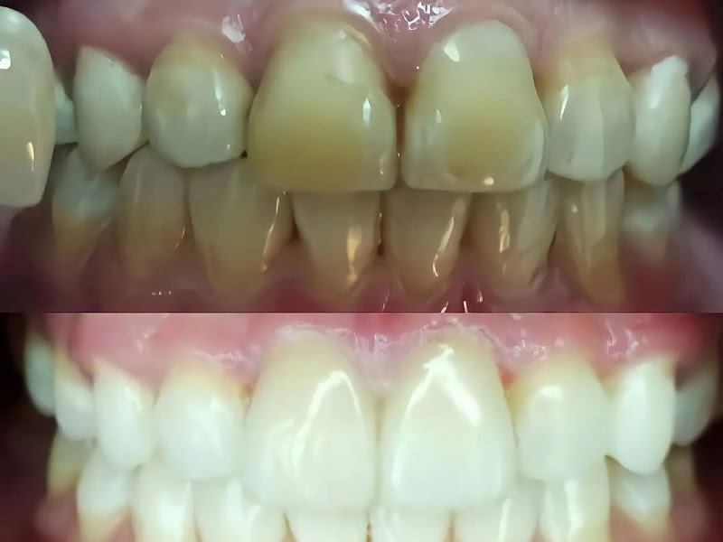 Foto 2 de PROWHITE ODONTOLOGIA