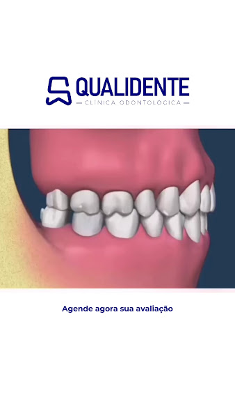 Foto 2 de Qualidente Odontologia