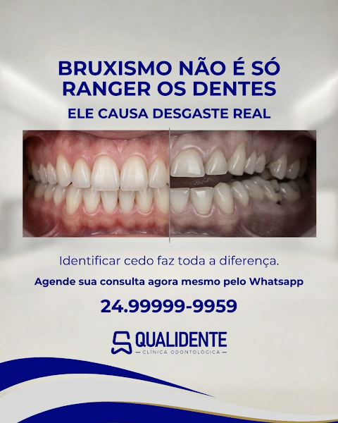 Foto 3 de Qualidente Odontologia
