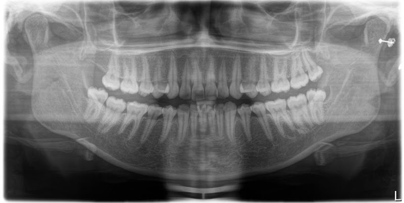 Foto 2 de Qualidoc Diagnóstico Odontológico por Imagem