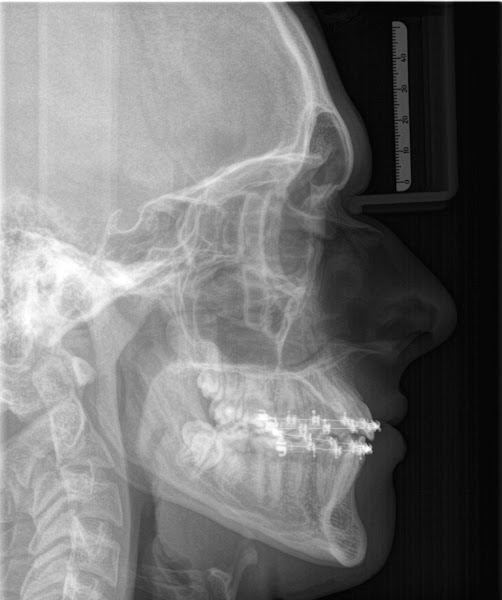 Foto 3 de Qualidoc Diagnóstico Odontológico por Imagem