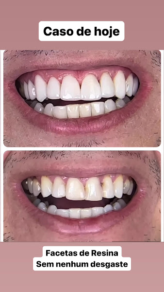 Foto 3 de Qualis Clínica Odontológica