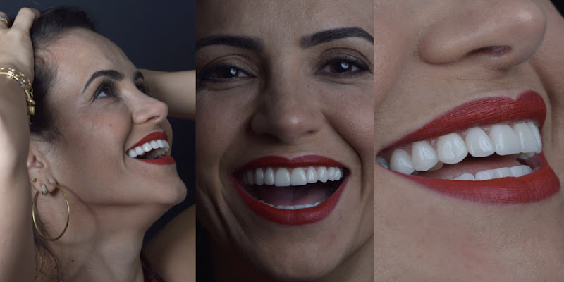 Foto 2 de Qualis Saúde Odontológica