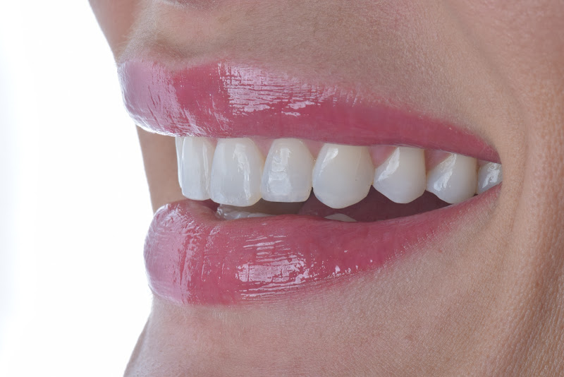 Foto 3 de Qualis Saúde Odontológica