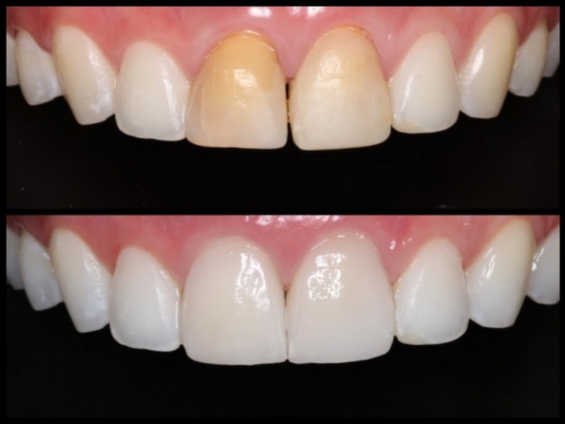 Foto 11 de Qualis Saúde Odontológica