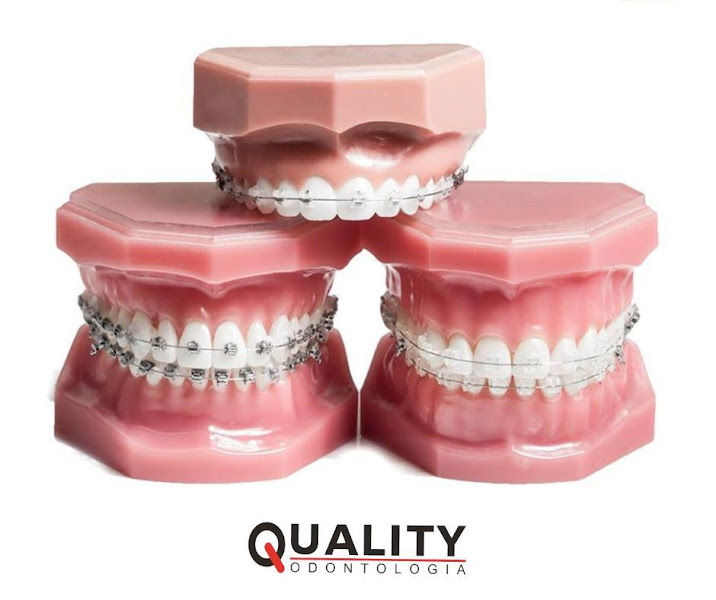 Foto 5 de Quality Odontologia - Vitória da Conquista