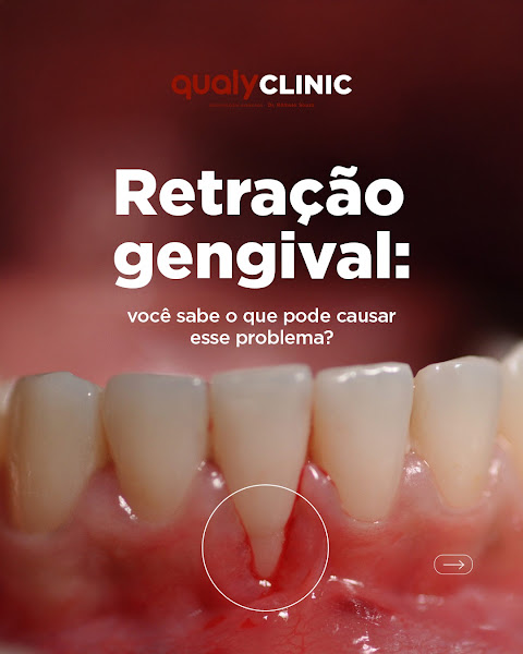 Foto 2 de QualyClinic Odontologia Avançada
