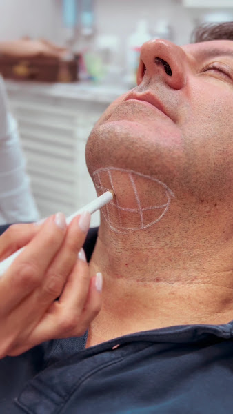 Foto 3 de Querido Odontologia / Dr. Maurício Querido / Implante Dentário / Dentista Campo Belo / Dentista São Paulo / Lente de Contato