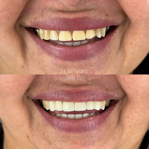 Foto 2 de Quero Sorrir / Clínica odontológica