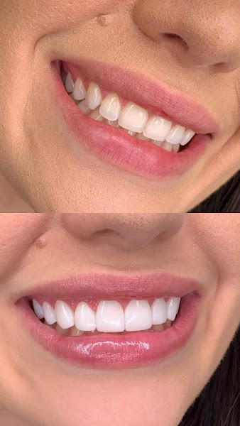 Foto 2 de R.A Odontologia Integrada