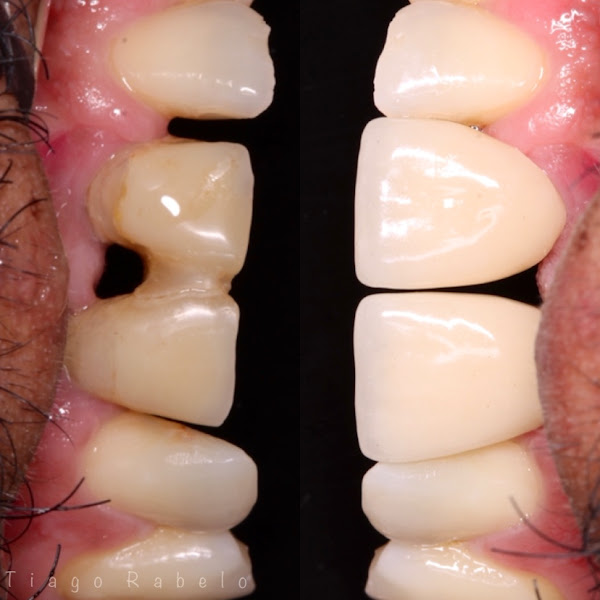 Foto 2 de Rabelo Odontologia