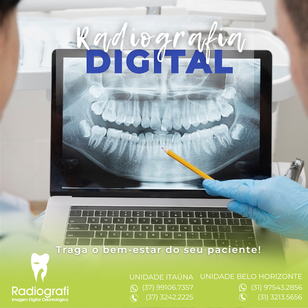 Foto 3 de Radiografi Digital Radiografia Odontológica
