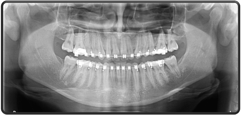 Foto 3 de Radiografias Odontológicas Floresta