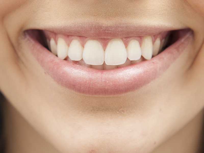 Foto 13 de Radiografias Odontológicas Pampulha