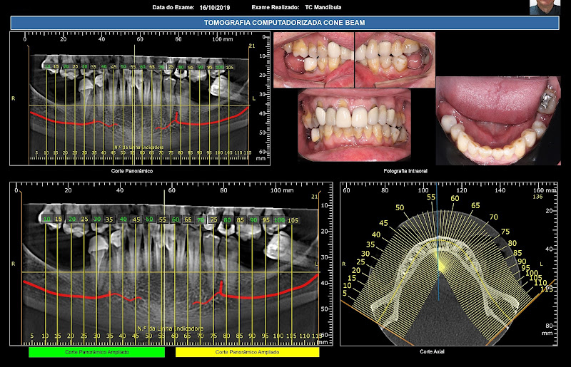 Foto 3 de Radiologia Odonto 4D - Santa Cruz do Sul - RS - Brasil