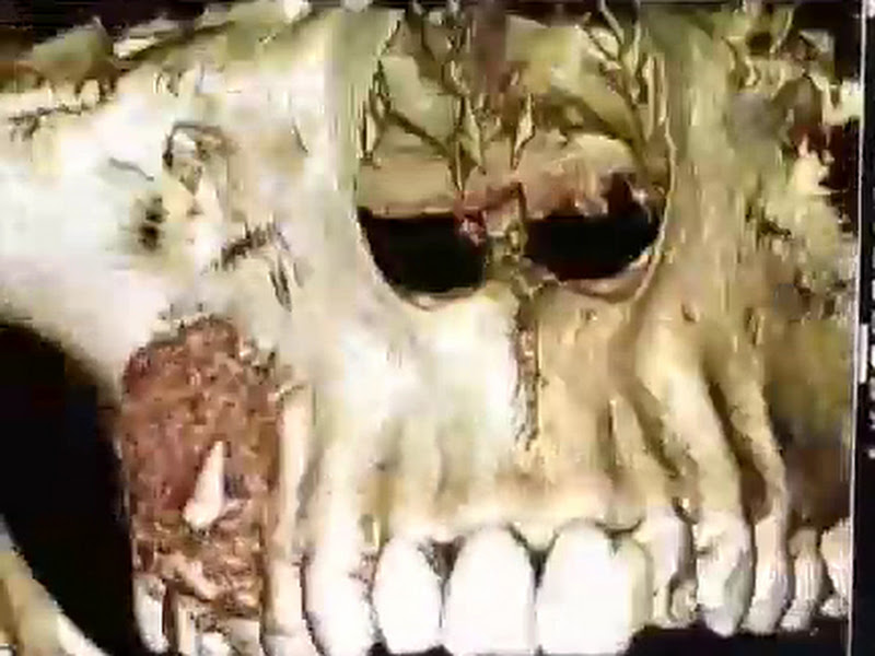 Foto 3 de Radiologia Odontológica e Imaginologia