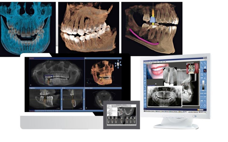 Foto 3 de Radiologia Odontológica