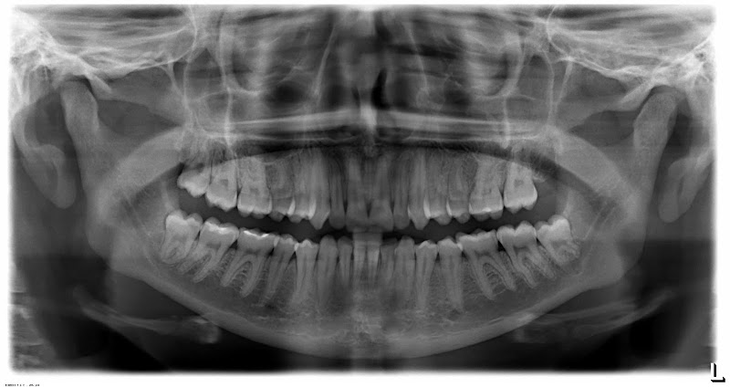 Foto 2 de RADIOLOGIA ODONTOLÓGICA ORLEANS