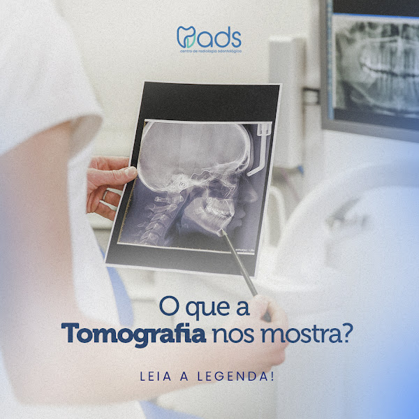 Foto 3 de Rads Centro de Radiologia Odontológica