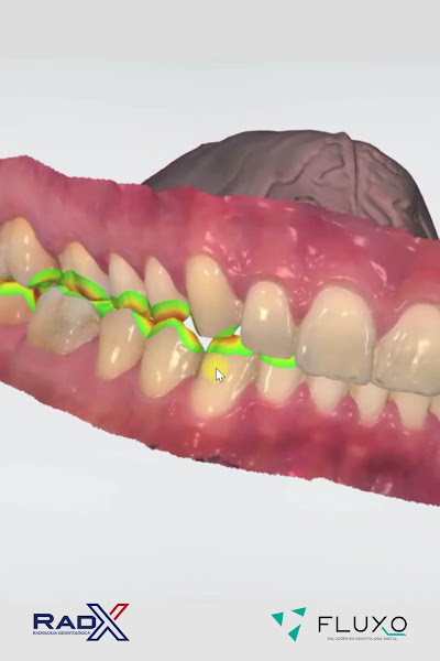 Foto 3 de RadX Radiologia e Tomografia Odontológica - Barra da Tijuca