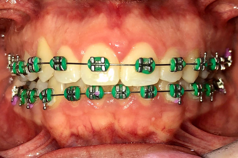 Foto 3 de RadX Radiologia Odontológica