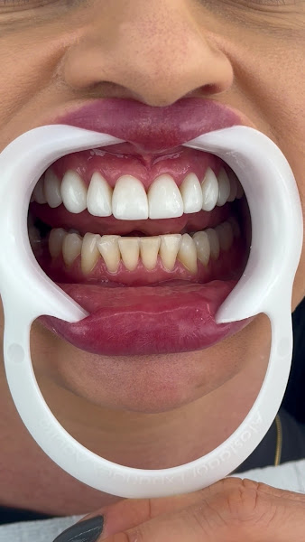 Foto 3 de Rafael Bortolaso