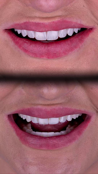 Foto 4 de Rafael Bortolaso