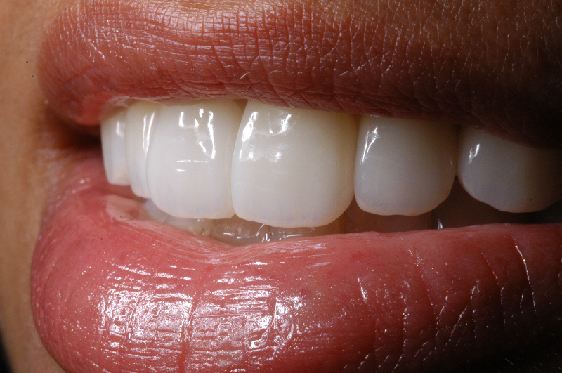 Foto 2 de Rafael LUNARDI - Odontologia Estética Restauradora e Reabilitação Oral