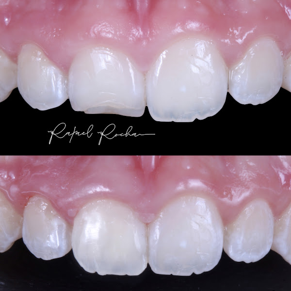Foto 2 de Rafael Rocha - Estética Dental