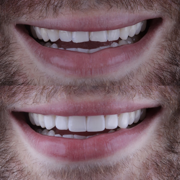 Foto 3 de Rafael Rocha - Estética Dental