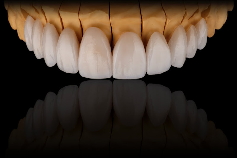 Foto 2 de Rafael Stoque Laboratório de Prótese Dentária