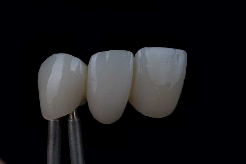 Foto 3 de Rafael Stoque Laboratório de Prótese Dentária