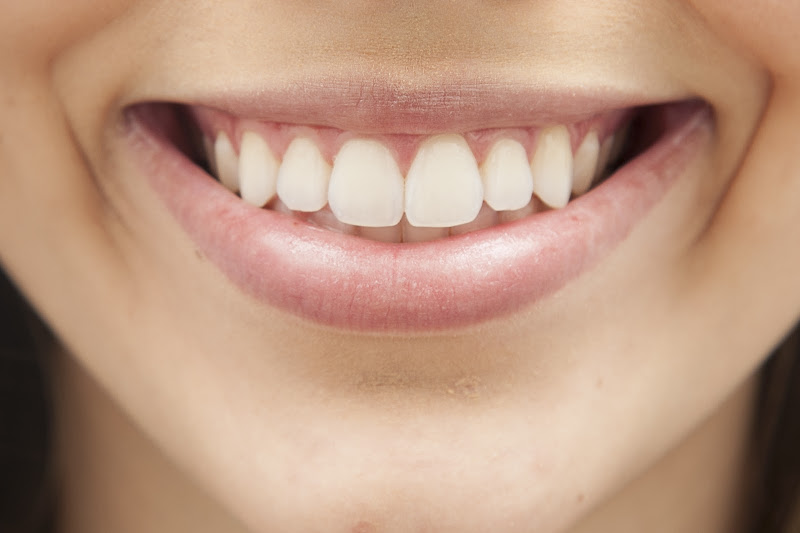 Foto 2 de Raio X Ouro Preto - Digital