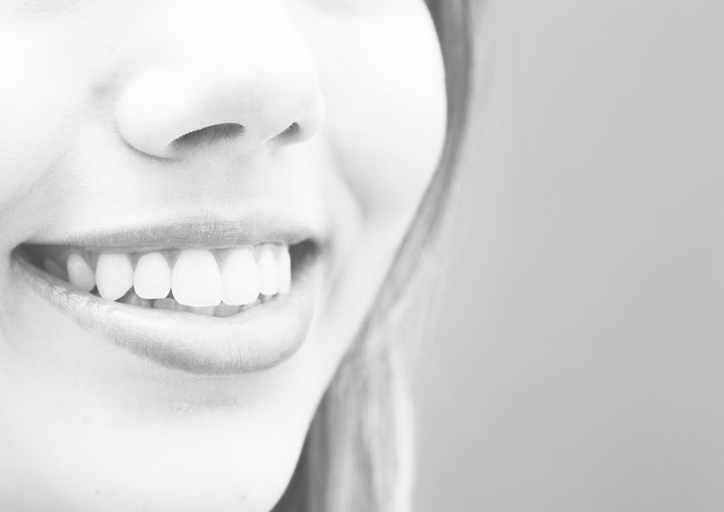 Foto 3 de Raio X Ouro Preto - Digital