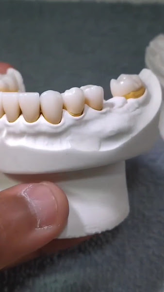 Foto 2 de Raiz Dental Lab