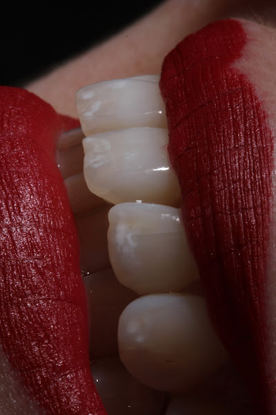 Foto 2 de Ralph Vigo Odontologia