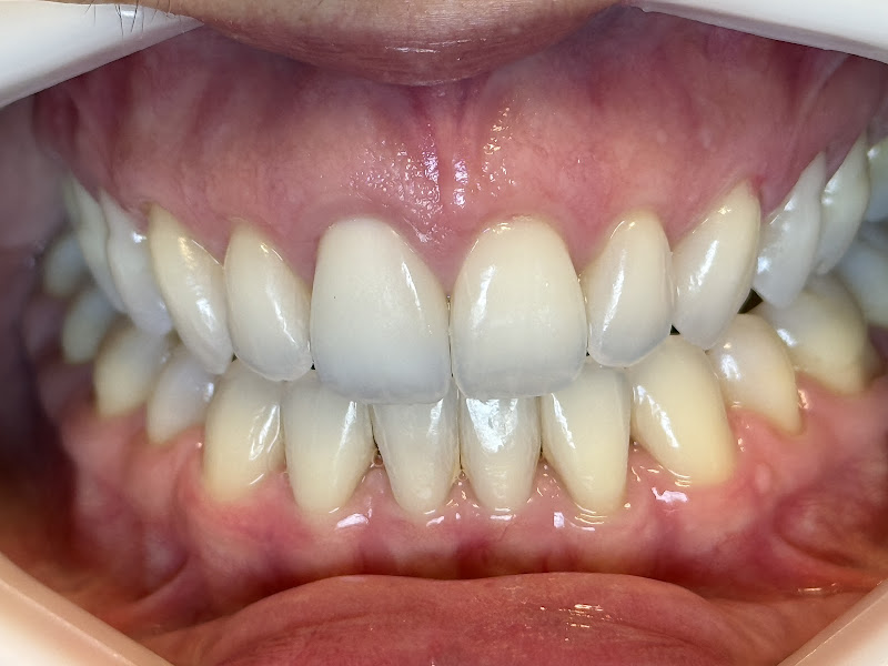 Foto 2 de Ranaira Sines Odontologia