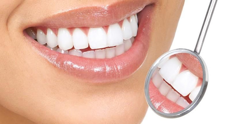 Foto 2 de Raoni Odontologia Estética