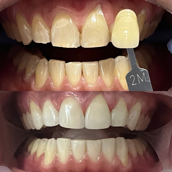 Foto 2 de Raquel Rizza Odontologia Estética