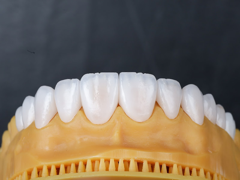 Foto de RB Estética Dental - Laboratório de Prótese Dentária