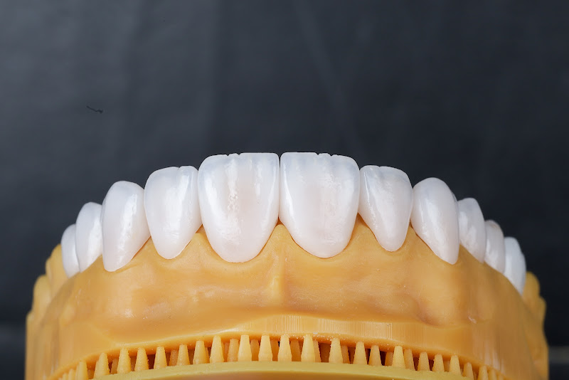 Foto 2 de RB Estética Dental - Laboratório de Prótese Dentária